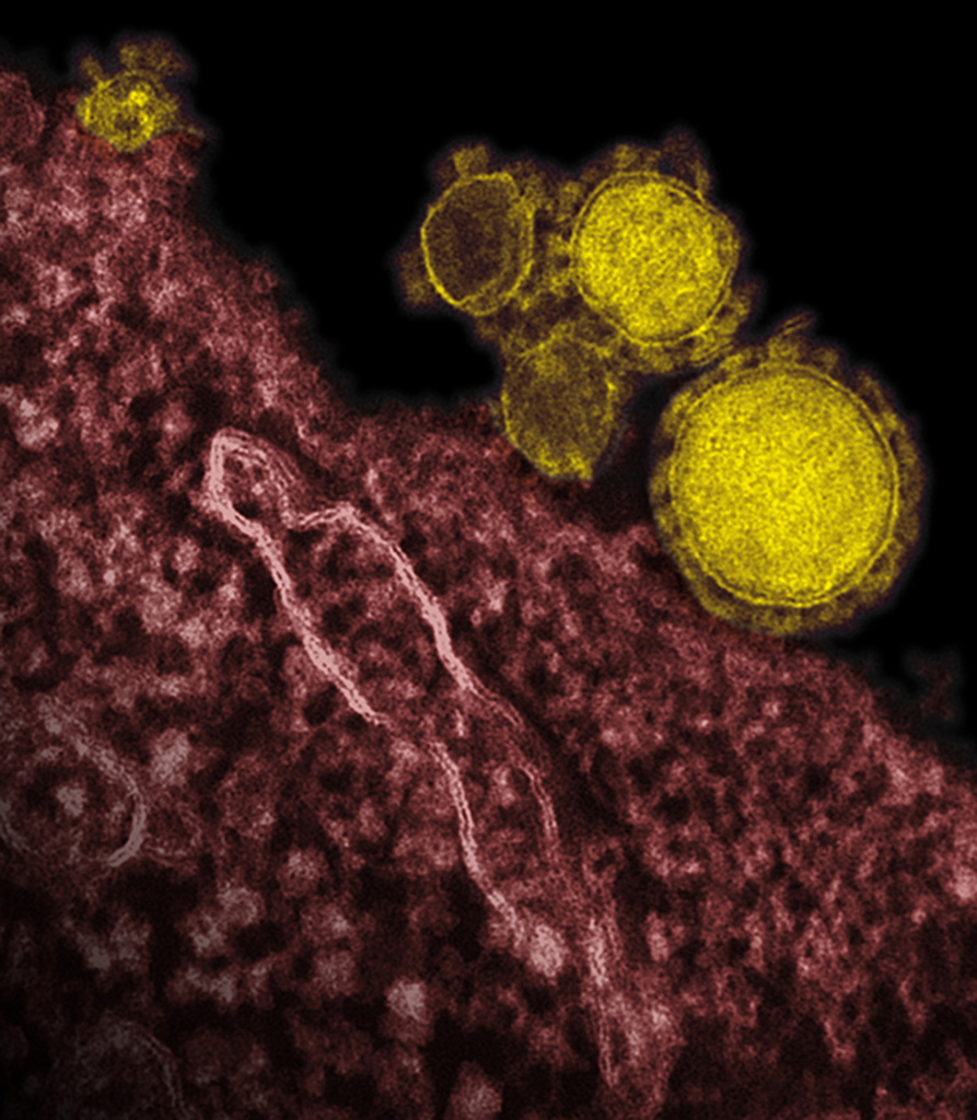 Un Saoudien atteint du coronavirus MERS est décédé, portant à 41 le nombre de morts liés à ce virus en Arabie saoudite.