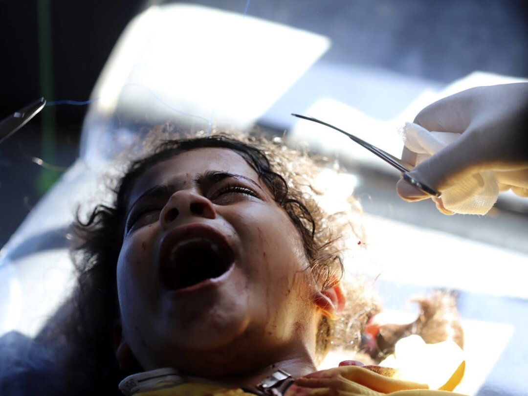 Des médecins palestiniens soignent une fillette blessée lors du bombardement israélien à l’hôpital du camp de réfugiés de Rafah, dans le sud de la bande de Gaza.