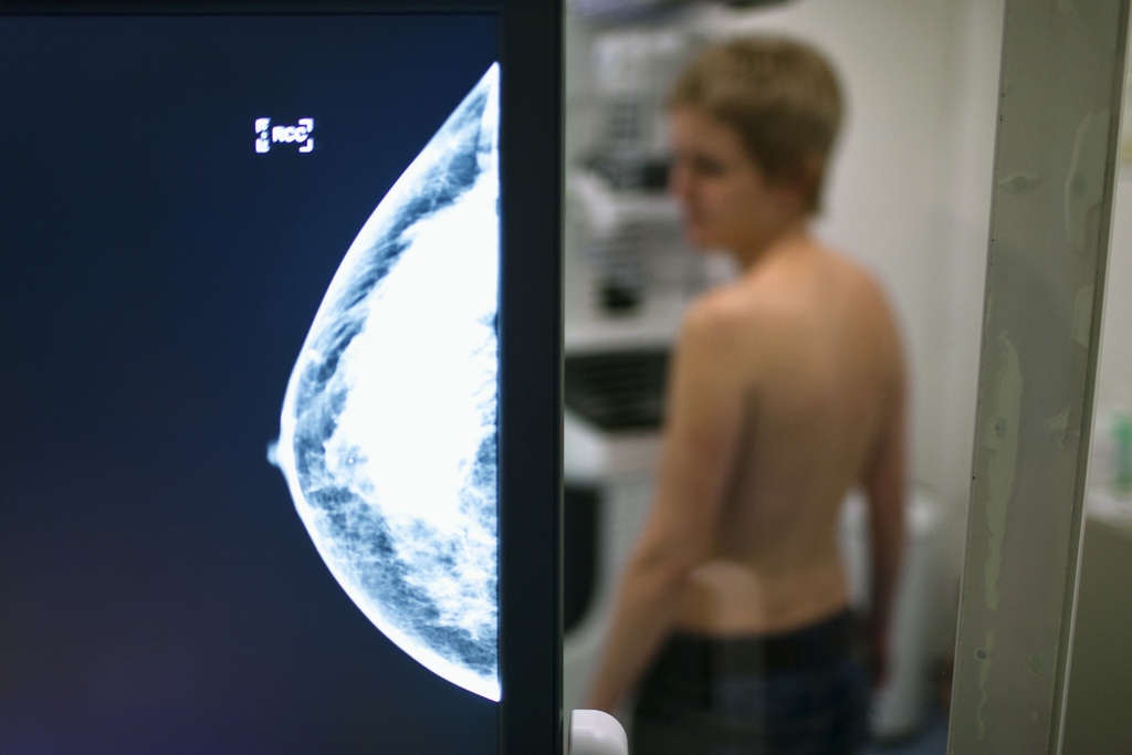 The X-ray of a woman's breast, which was just taken, appears on a screen at the Clinic Engeried in Bern, Switzerland, pictured on December 8, 2009. Mammography is a method for early detection of breast cancer (breast carcinoma). (KEYSTONE/Gaetan Bally)

Die soeben erstellte Roentgenaufnahme einer weiblichen Brust erscheint am 8. Dezember 2009 in der Klinik Engeried in Bern auf einem Bildschirm. Die Mammografie ist eine Methode zur Frueherkennung von Brustkrebs (Mammakarzinom). (KEYSTONE/Gaetan Bally)