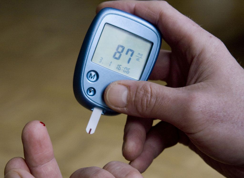 FILE - This Jan. 3, 2009 file photo shows a person with diabetes testing his blood sugar level in Kamen, Germany. New research published in the Thursday, Aug. 8, 2013 New England Journal of Medicine suggests a possible way to help prevent Alzheimer's disease: Keeping blood sugar at a healthy level. A study found that higher glucose levels, even those well short of diabetes, seemed to raise the risk for dementia. (AP Photo/Joerg Sarbach, File)