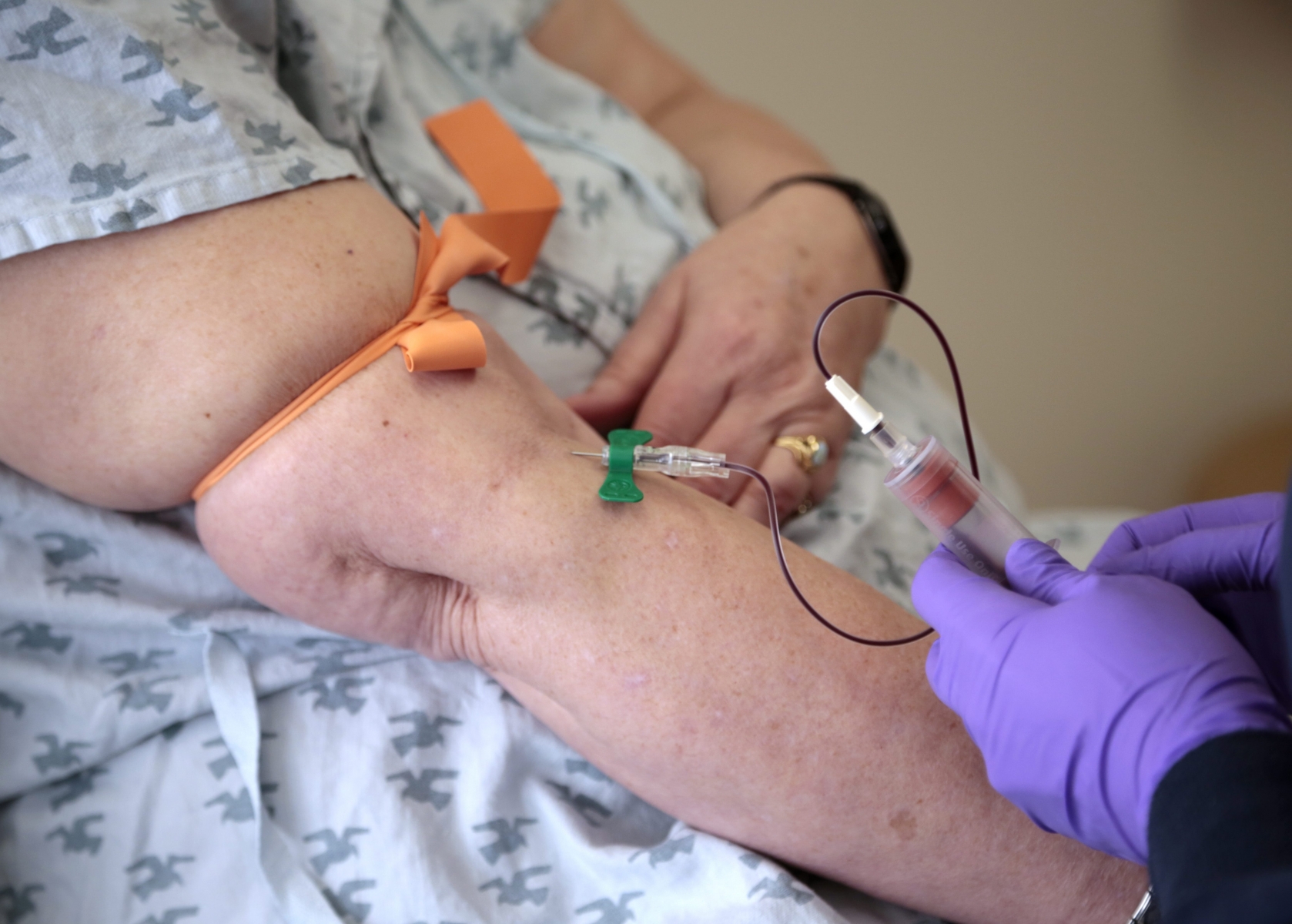 Patient Carole Linderman has her blood drawn for a liquid biopsy at Jefferson University Hospital in Philadelphia on Tuesday, April 28, 2015. The test detected Carole Linderman's breast cancer recurrence months before it normally would have been found. (AP Photo/Jacqueline Larma)