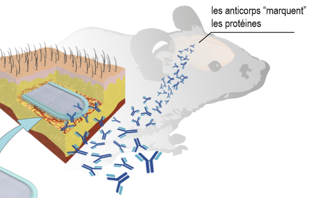 Les chercheurs de l'EPFL ont fait des tests sur une souris. Ils lui ont posé un implant dans le cerveau. Les résultats sont positifs.