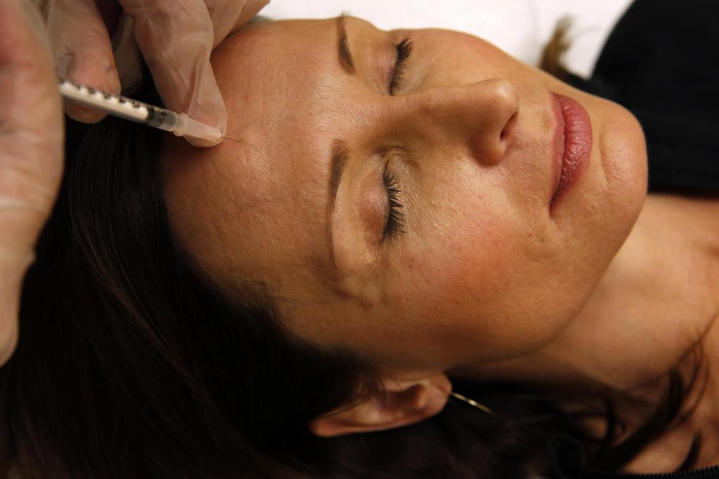 Des chercheurs de Zurich mènent une étude clinique sur les effets du Botox sur le cerveau
