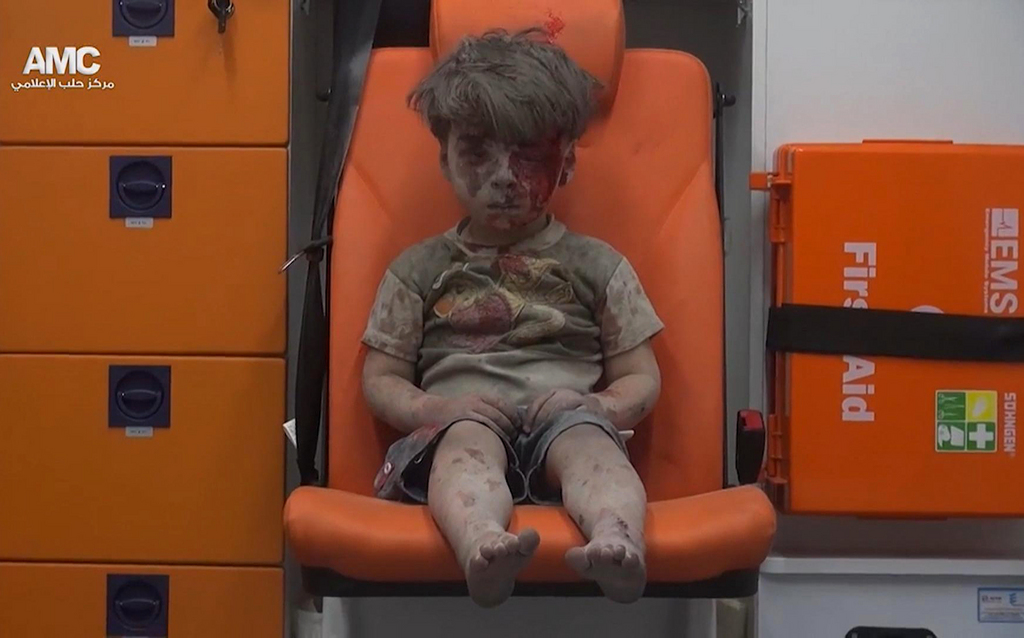 Il y a deux mois, Omran Daqneesh était devenu le visage de l'enfance syrienne sacrifiée par son gouvernement.