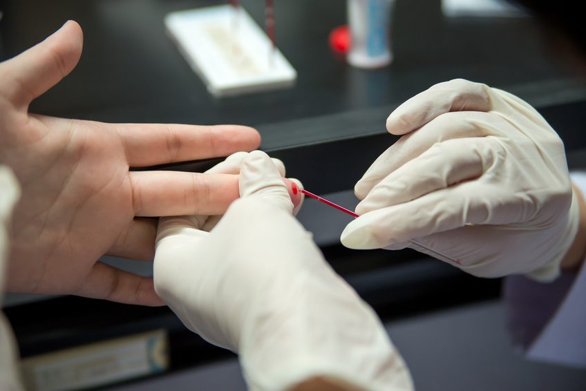 Close-up detail of blood being collected by the use of a capillary tube. Healthcare and medicine concept. Capillary tube blood collection
