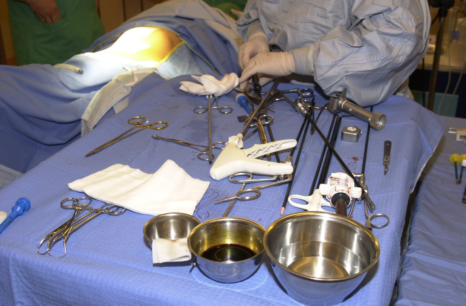Hopital de Nyon opération au moyen d'un robot  bras articulé
ablation vésicule biliaire par le medecin chirurgien Alfred 
Blaser 25.09.2000 Hopital de Nyon opération au moyen d'un robot  bras articulé
