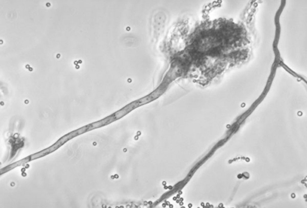 Le champignon est déjà présent dans les doses et développe des méningites chez les patients.