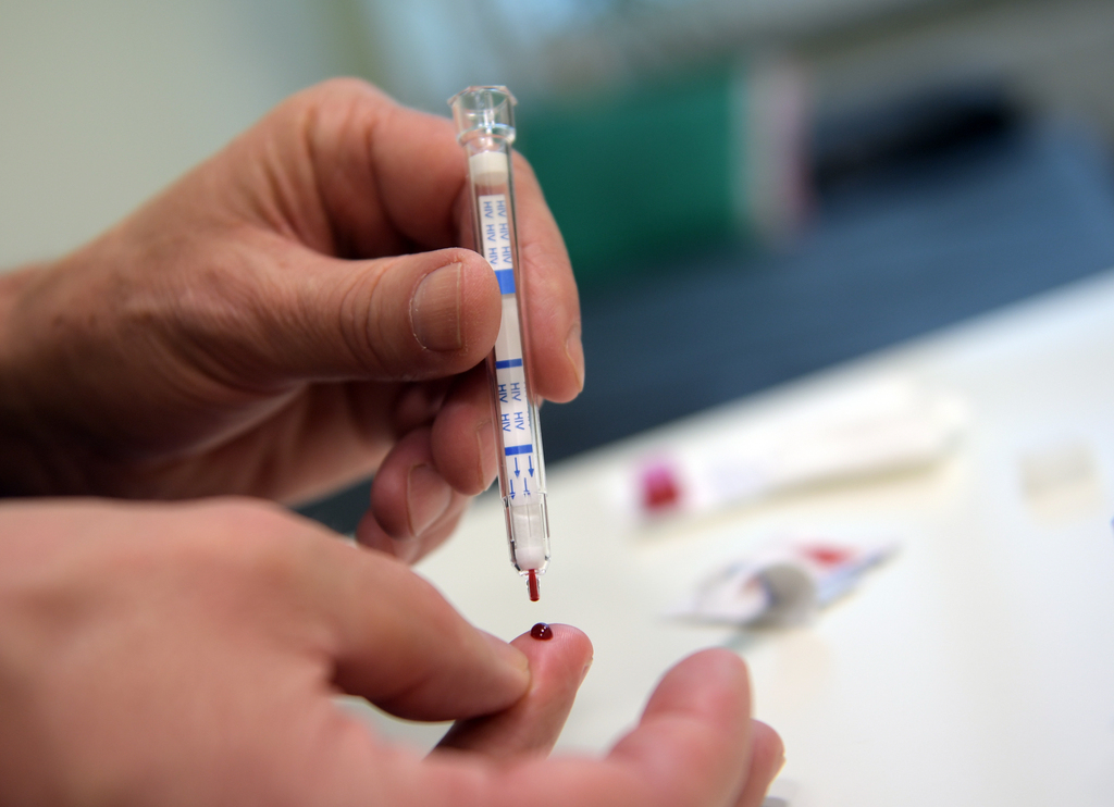 Les discussions sont en cours pour autoriser les kits d'autodépistage du VIH en Suisse.