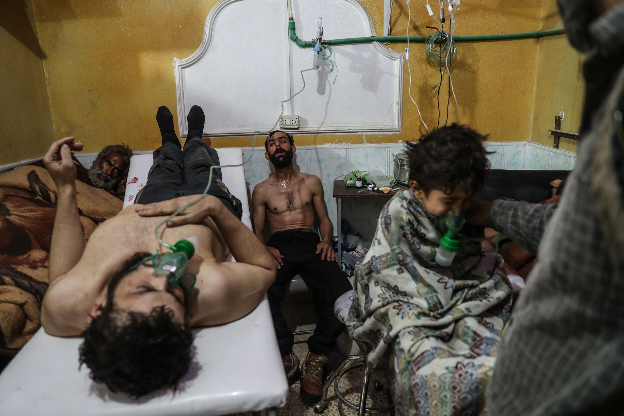 epa06565557 Affected people receive treatment after a gas attack on al-Shifunieh village, in Eastern Ghouta, Syria, 25 February 2018 (issued 26 February 2018). According to activists working in the area, more than 18 people were affected by poisenous gas, and one child was killed, during an attack on the village of al-Shifunieh. Government forces loyal to President Bashar al-Assad are currently conducting an air and ground offensive in Eastern Ghouta. The offensive was initiated soon after the United Nations passed a resolution calling for a 30-day cessation of hostilities in Syria.  EPA/MOHAMMED BADRA SYRIA CONFLICT
