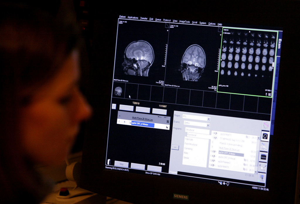 La signature neurologique de la douleur a été observée par des scientifiques en analysant des images du cerveau avec un scanner, révèle jeudi une recherche. 