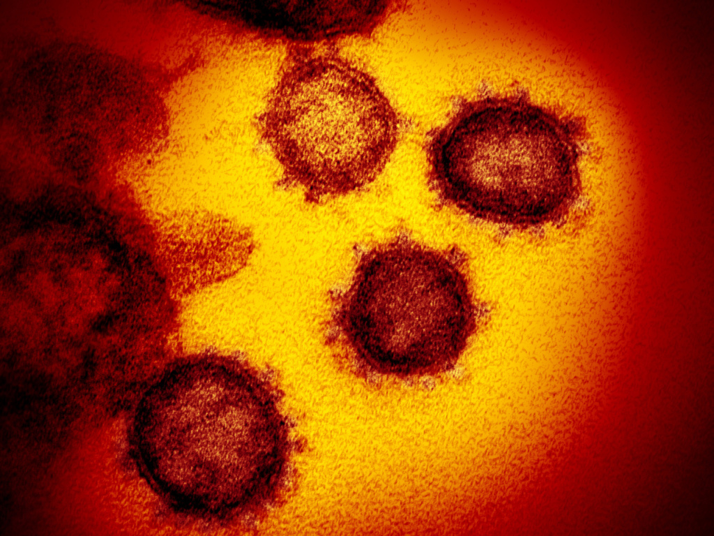 Le virus SARS-CoV-2 est à l'origine de la pandémie de maladie à coronavirus (ARCHIVES).